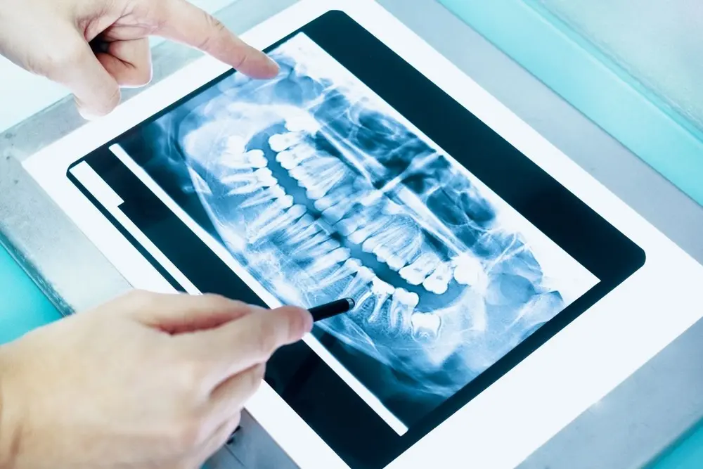 impressao-3d-entenda-tecnologia-aplicaçoes-odontologia
